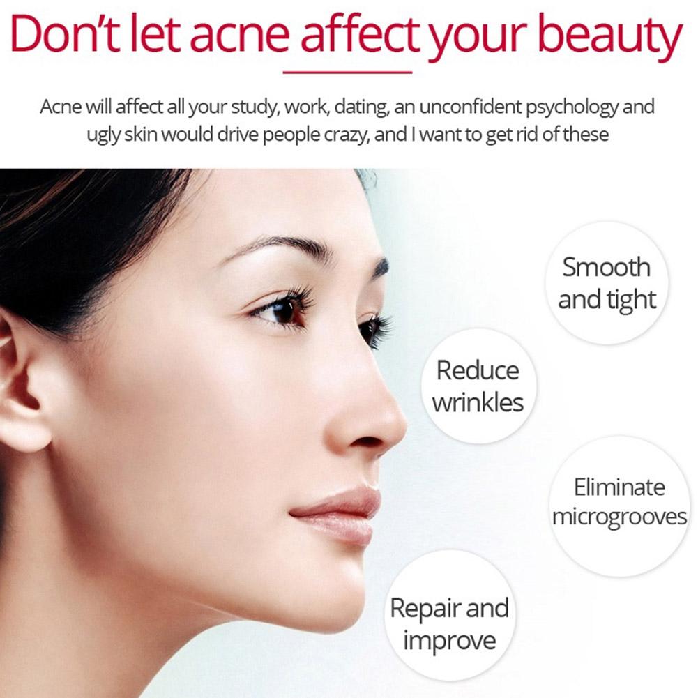 Retinol Lifting Firming ครีมลบ - Beauty Glazed Makeup บทวิจารณ์และราคา